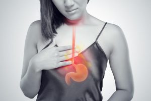 Acid Reflux Surgery: When Is It Necessary and What to Expect
