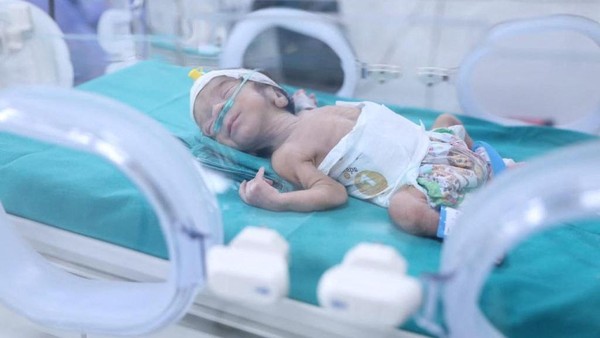 Bayi Prematur: Cara Merawat Si Kecil yang Lahir Lebih Dini 1 Bayi Prematur