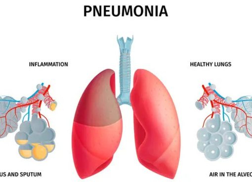 Cegah Pneumonia