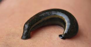 Terapi Lintah: Rahasia Pengobatan Tradisional yang Kembali Diminati Dunia Modern