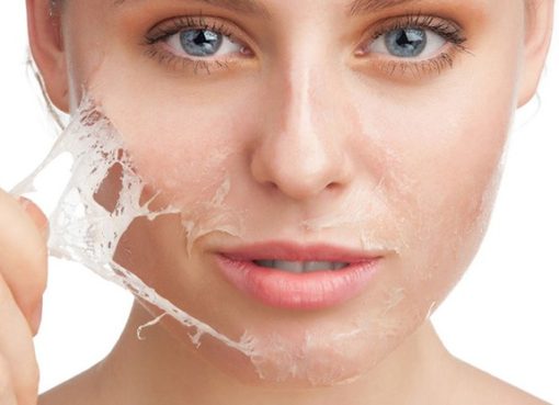 Penyebab Kulit Kering