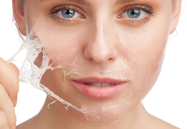 Penyebab Kulit Kering