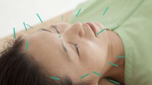 Refleksi Akupuntur, Kombinasi Relaksasi dan Terapi untuk Tubuh